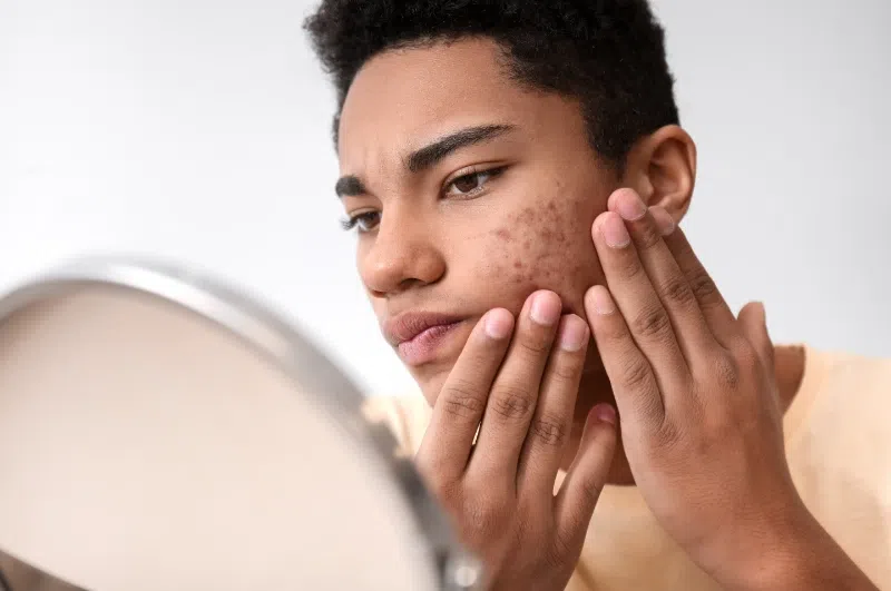 5 Ways Stress Ages Your Skin (and What to Do About It)