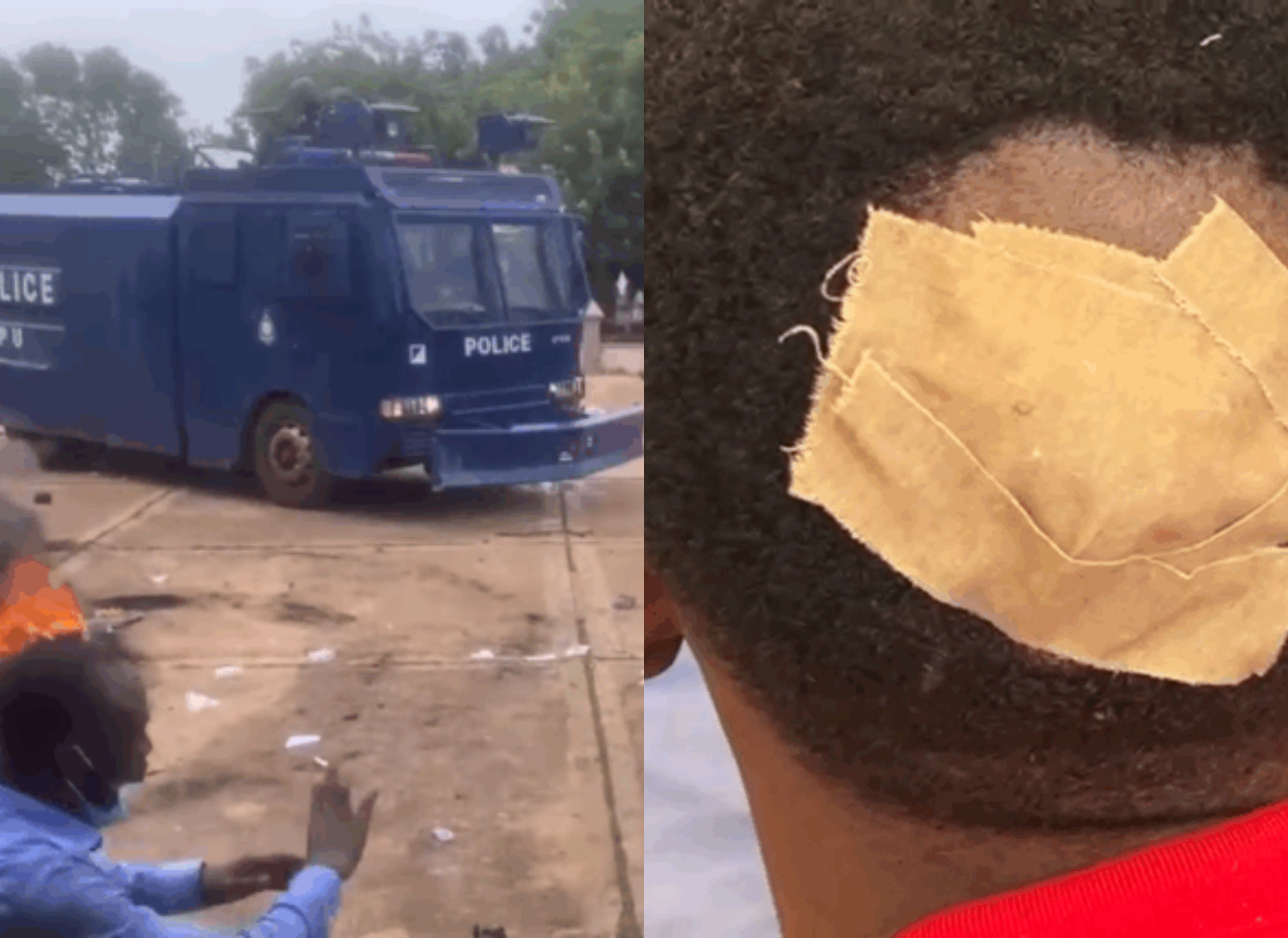 Scores injured as Tamale Technical University students clash with police during protest