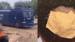 Scores injured as Tamale Technical University students clash with police during protest