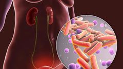 5 health complications you can develop from having anal sex