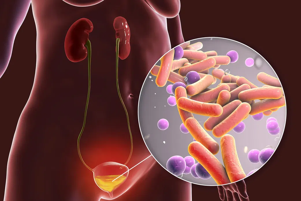 5 health complications you can develop from having anal sex