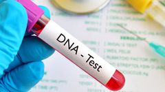 DNA Test