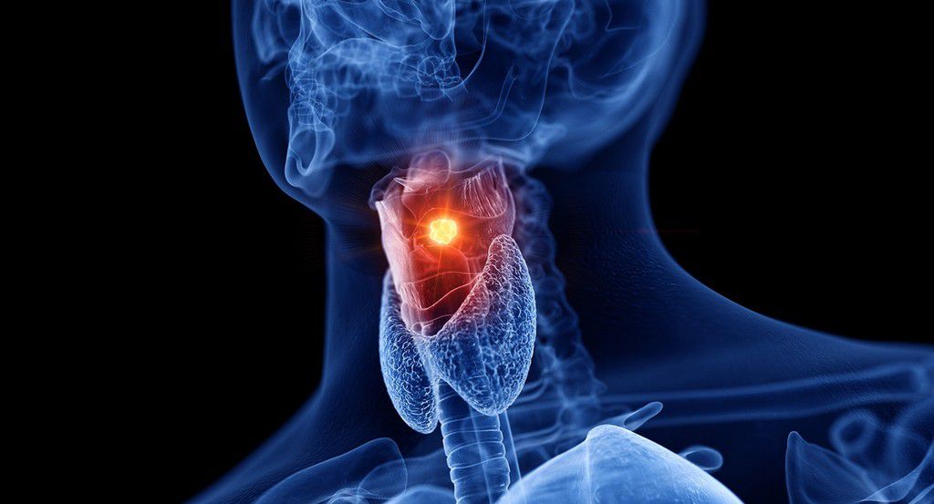 Here are 10 signs and symptoms of throat cancer you should know