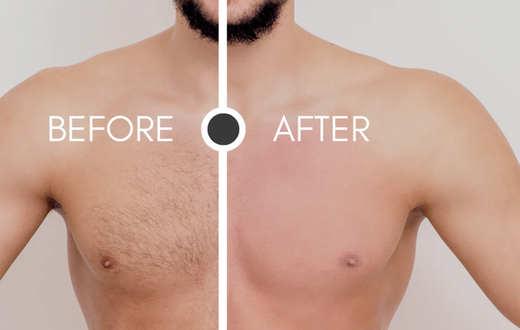 How to get rid of body hair [WaxFactor]