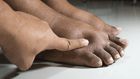 What causes feet swelling in pregnant women? [careplusfoot]
