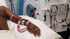 Free dialysis treatment for kidney patients set to begin December 1 – Dr Bawumia