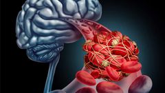 5 reasons you get a headache after an intense orgasm and how to prevent it
