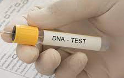 DNA Test