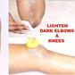 Here are 5 ways to naturally get rid of dark elbows and knees