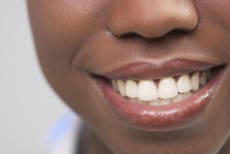 5 natural ways to make your teeth white and shiny