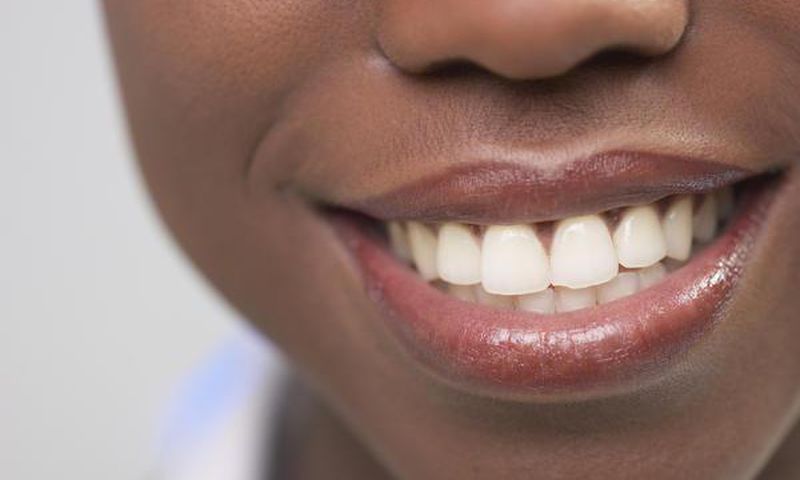 5 natural ways to make your teeth white and shiny