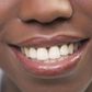 5 natural ways to make your teeth white and shiny