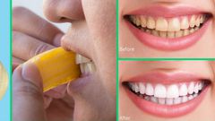 How to whiten the teeth using banana peels