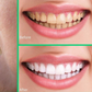 How to whiten the teeth using banana peels