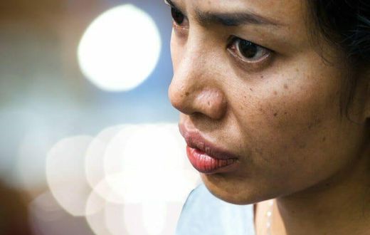 Natural remedies to remove dark spots on your face  [homeremedyhacks]