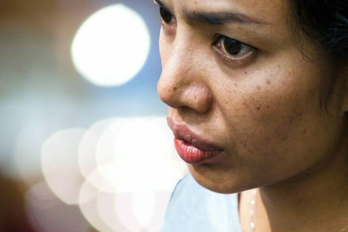 Natural remedies to remove dark spots on your face  [homeremedyhacks]