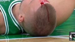 Basketball star suffers serious head injury as blood gushes out from forehead (Video)
