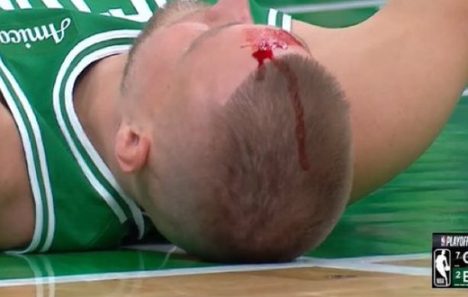 Basketball star suffers serious head injury as blood gushes out from forehead (Video)