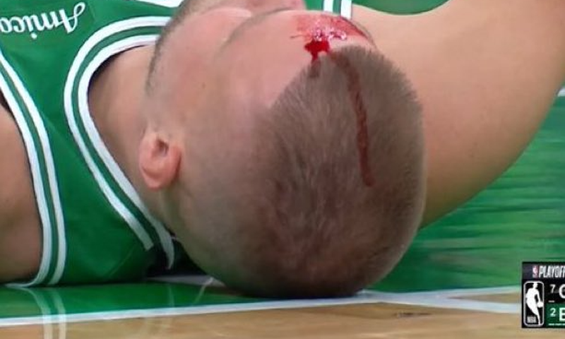 Basketball star suffers serious head injury as blood gushes out from forehead (Video)