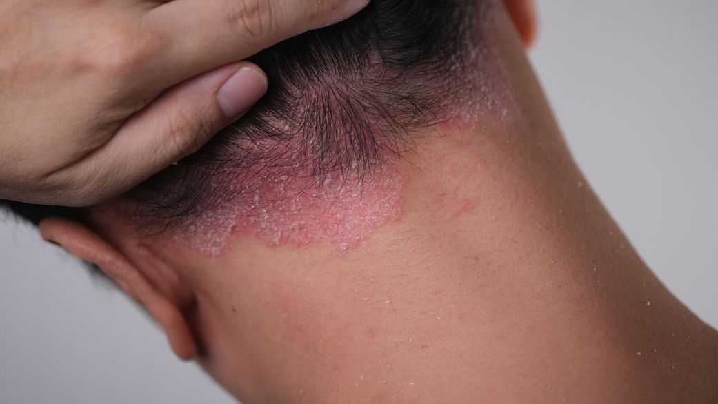 8 health complications you can get from worrying too much