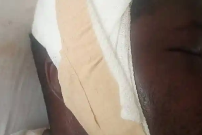 Man brutally beaten over alleged disappearance of Okada rider's penis at Senya Bereku