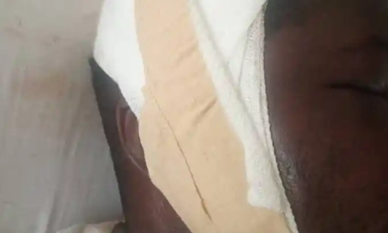 Man brutally beaten over alleged disappearance of Okada rider's penis at Senya Bereku