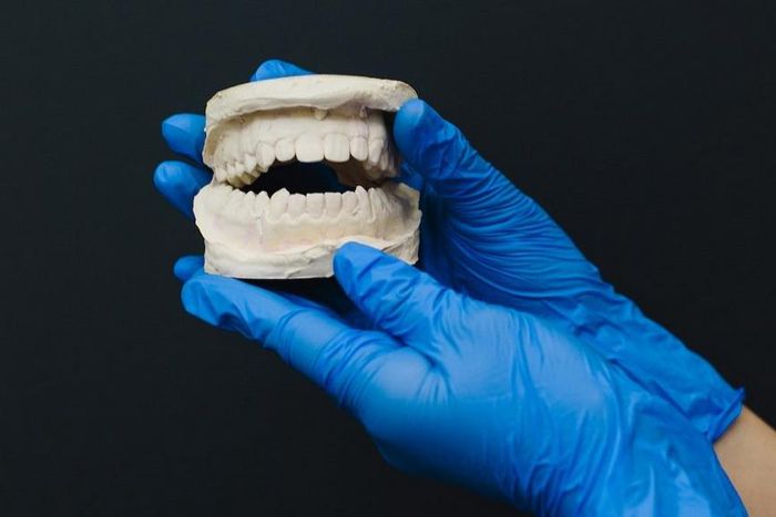A person with latex gloves holding a dental cast [Photo: Polina Zimmerman]