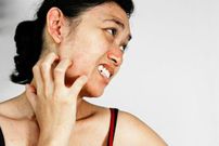 Prolonged lack of hygiene can cause your skin to harden [List25]