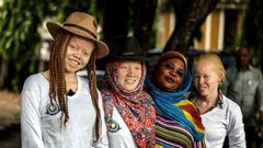 Tanzania's human rights campaigners say the number of attacks against albinos is in sharp decline, but their graves are increasingly being desecrated instead and their remains exhumed