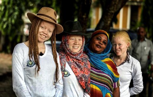 Tanzania's human rights campaigners say the number of attacks against albinos is in sharp decline, but their graves are increasingly being desecrated instead and their remains exhumed