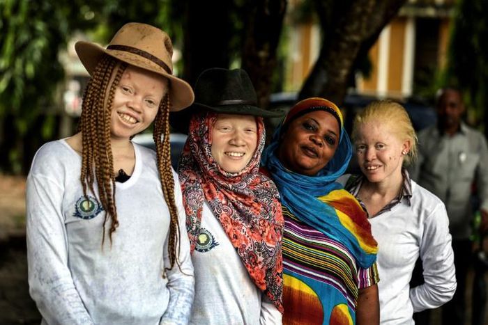 Tanzania's human rights campaigners say the number of attacks against albinos is in sharp decline, but their graves are increasingly being desecrated instead and their remains exhumed