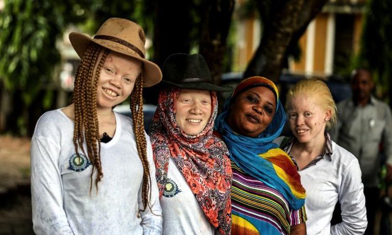Tanzania's human rights campaigners say the number of attacks against albinos is in sharp decline, but their graves are increasingly being desecrated instead and their remains exhumed