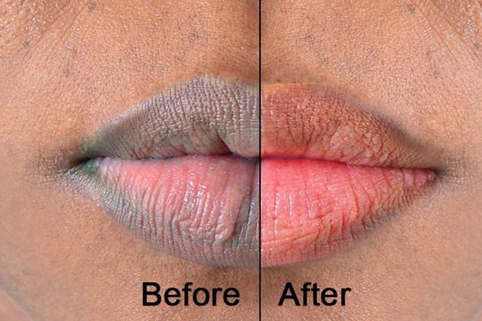 5 kitchen ingredients that you can use for pink lips [Medium]