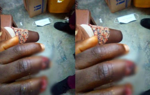 Woman slashes 5-year-old boy’s fingers for allegedly trying to steal fish