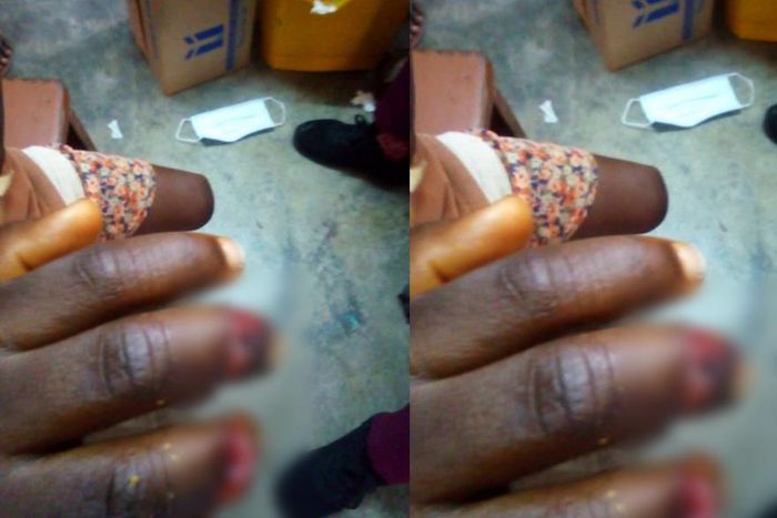 Woman slashes 5-year-old boy’s fingers for allegedly trying to steal fish
