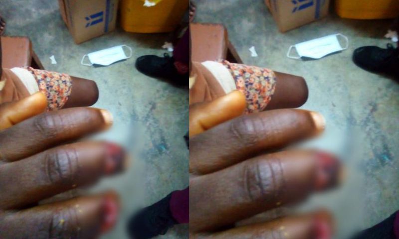 Woman slashes 5-year-old boy’s fingers for allegedly trying to steal fish