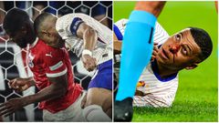 Video: Mbappe sustains broken nose from clash of heads with Kevin Danso