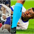 Video: Mbappe sustains broken nose from clash of heads with Kevin Danso