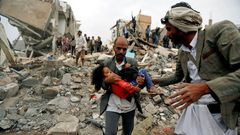 7 heartbreaking images show why US lawmakers want to stop supporting the brutal Saudi-led war in Yemen that's seen indiscriminate attacks and left millions at the brink of famine