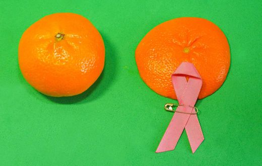 Breast Cancer Women who test positive for certain gene mutations or have a family history of breast cancer may choose to have a prophylactic mastectomy.japatino / Getty Images