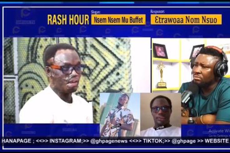 Man about to travel to Canada suffers acid attack by Pragya rider hired by girlfriend