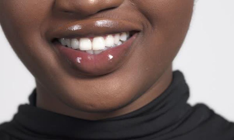 Woman with big lips