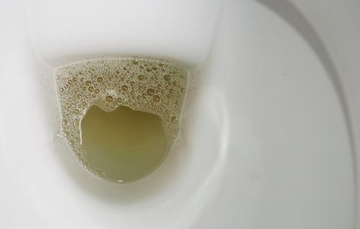 It's essential to pay attention to the characteristics of your urine.