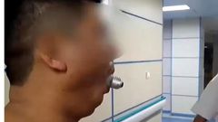 Doctors dislocate man’s jaw to remove light bulb stuck in his mouth in online challenge