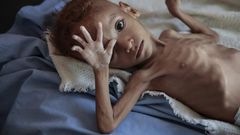 7 heartbreaking images show why US lawmakers want to stop supporting the brutal Saudi-led war in Yemen that's seen indiscriminate attacks and left millions at the brink of famine
