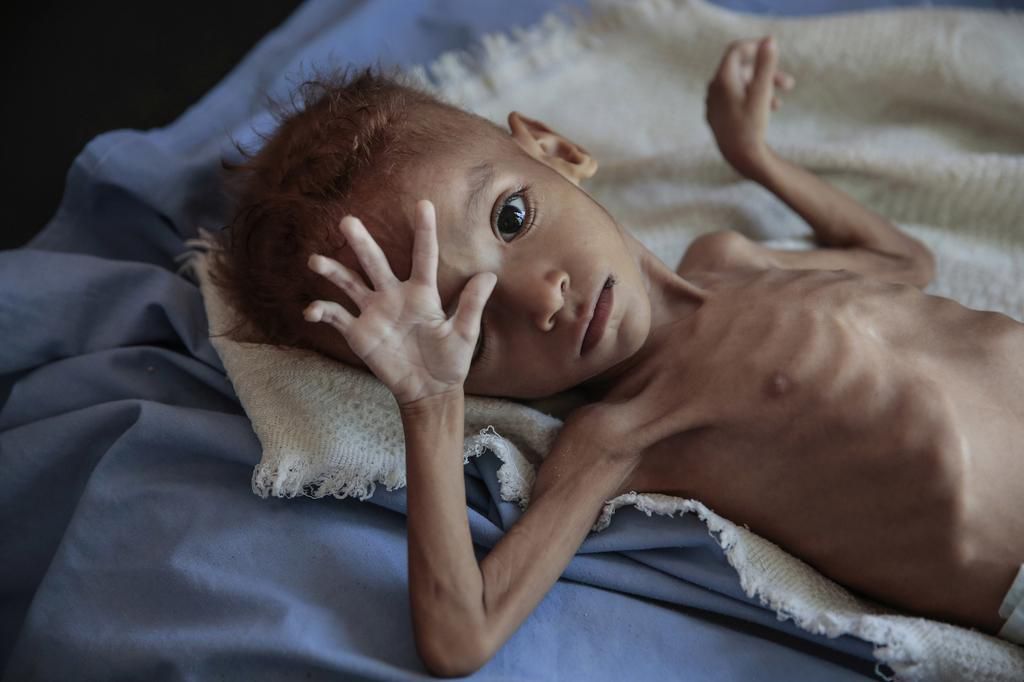 7 heartbreaking images show why US lawmakers want to stop supporting the brutal Saudi-led war in Yemen that's seen indiscriminate attacks and left millions at the brink of famine