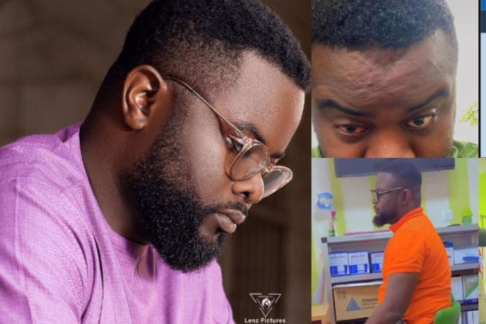 Yolo star Drogba suffering from pain and double vision with right eye- Sisiter reveals