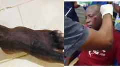 Armed robbers attack University of Ghana professor, 2 police officers injured