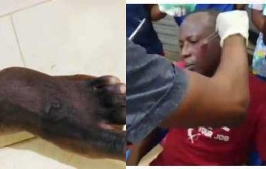 Armed robbers attack University of Ghana professor, 2 police officers injured