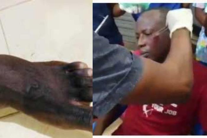 Armed robbers attack University of Ghana professor, 2 police officers injured